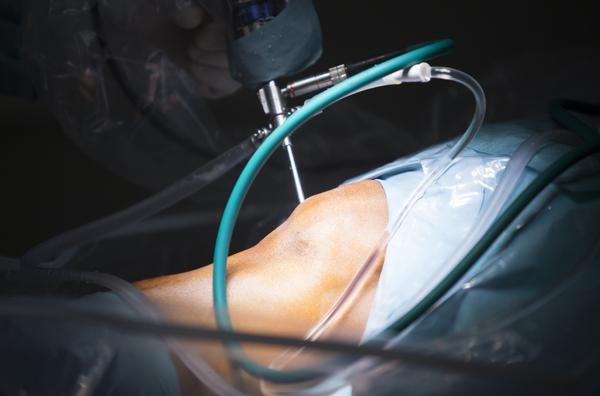 Knee Arthroscopy Treatment in Nashik